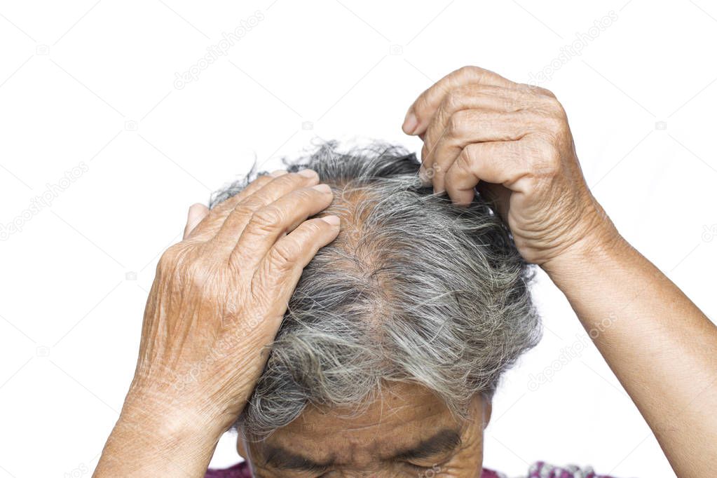 Old woman felt a lot of anxiety about hair loss issue on white b