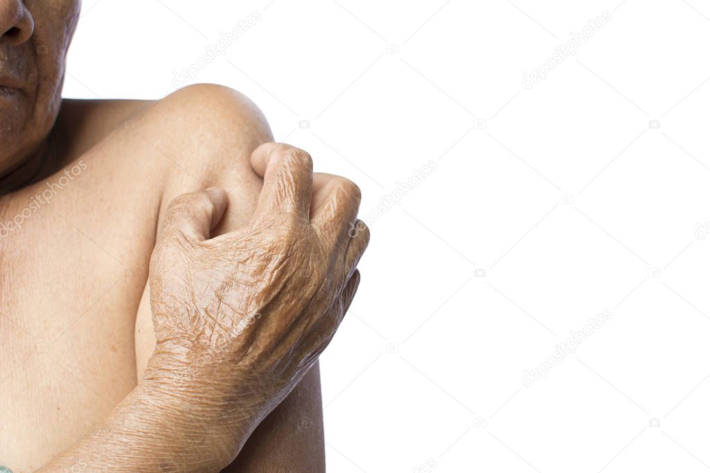 Old hands itching in arm on white background, dermatitis concept