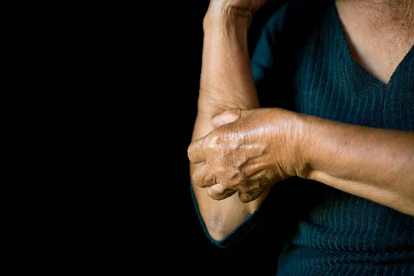 Manos Viejas Picazón Brazo Fondo Negro Concepto Dermatitis —  Fotos de Stock