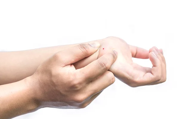 Mãos Femininas Coceira Braço Fundo Branco Conceito Dermatite — Fotografia de Stock