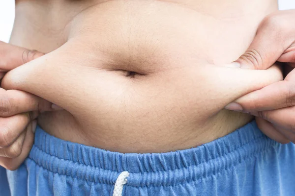 Primer Plano Superficie Abdominal Femenina Grasa Concepto Atención Médica — Foto de Stock