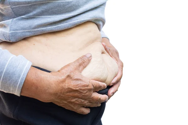 Primer Plano Superficie Abdominal Femenina Grasa Concepto Atención Médica — Foto de Stock