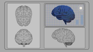 3D beyin analizi arayüzü ekranda gri Bg