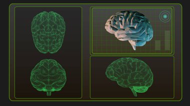 3D beyin analizi arayüzü ekranda siyah Bg