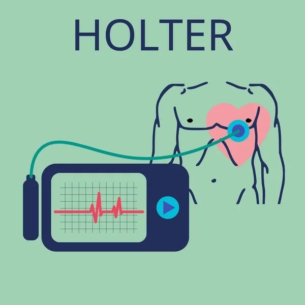 Monitorização diária do ECG. Holter para uso diário. O dispositivo monitora o sangramento do coração. E pode prevenir um ataque cardíaco — Vetor de Stock