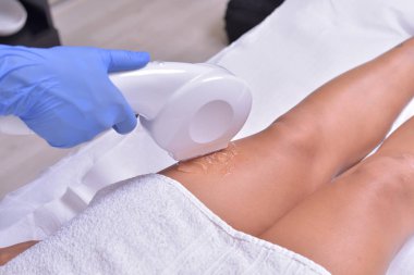 Bir dalga boyu ile diode lazer ile epilasyon, 808 nm. Epilasyon bacak ve kalça ile saç kaldırma aygıt. Epilasyon için donatım.