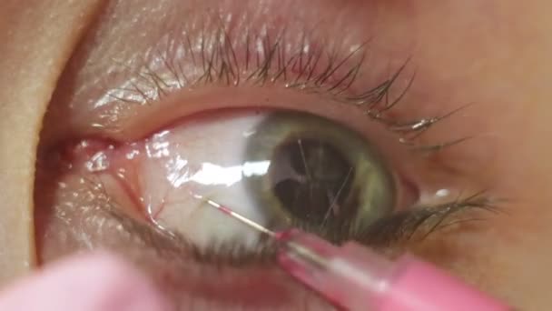 Artista del tatuaje hace el tatuaje en el globo ocular — Vídeos de Stock