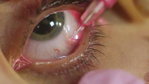 Tattoo artist does the tattoo on the eyeball — Stock Video