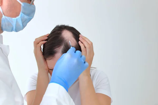 Bir kızın kel kafasına yapılan iğneler. Gerçek bir alopecia areata.