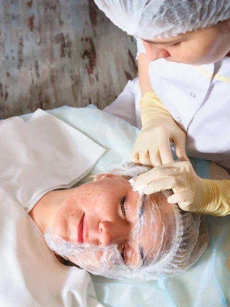 Hyaluronik asit ile kozmetik enjeksiyonu.