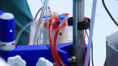 Kalp akciğer makinesine ameliyat odasında kan pompalama