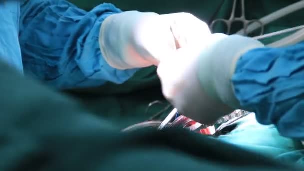 Doctors with tools in hands making surgery — Stock Video