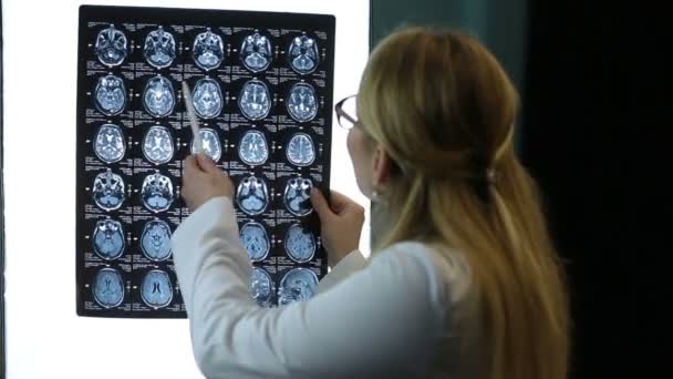 Arzt untersucht MRI-Scan eines Patienten aufmerksam — Stockvideo