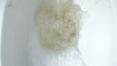 Sarı çiş sifonu Close-Up