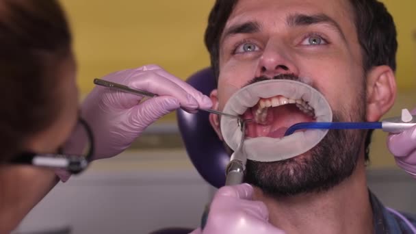 Retrato do paciente masculino durante a limpeza dentária — Vídeo de Stock