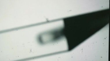 Embriyonun vitrifikasyona hazır hale getirilmesine yakın çekim