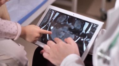 Doktor ekranda beyin taramalarıyla tableti tutuyor.