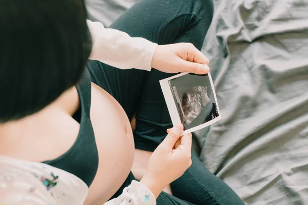Joven hermosa mujer embarazada asiática con película de ultrasonido — Foto de Stock