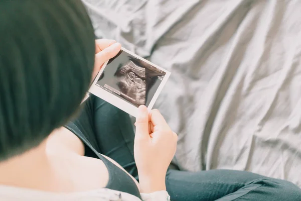 Joven hermosa mujer embarazada asiática con película de ultrasonido — Foto de Stock