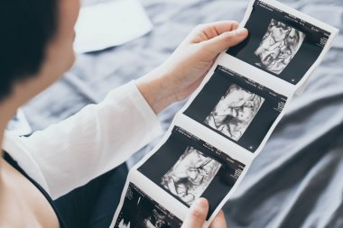 Genç güzel Asyalı hamile kadın ultrason filmi ile