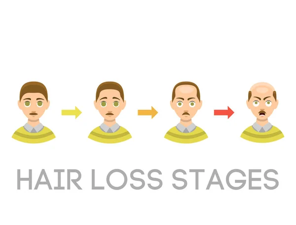 Informações gráfico de estágios de perda de cabelo tipos de calvície ilustrada no vetor de cabeça masculino . — Vetor de Stock