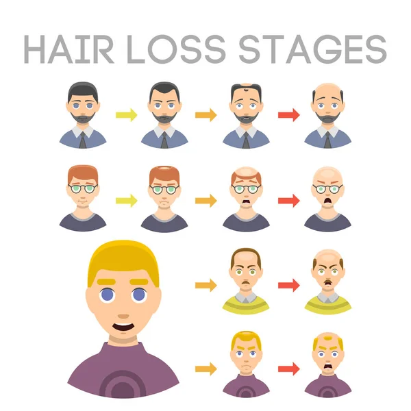 Informatie haartypes verlies stadia van kaalheid geïllustreerd op mannelijke hoofd vector rekeningschema. — Stockvector