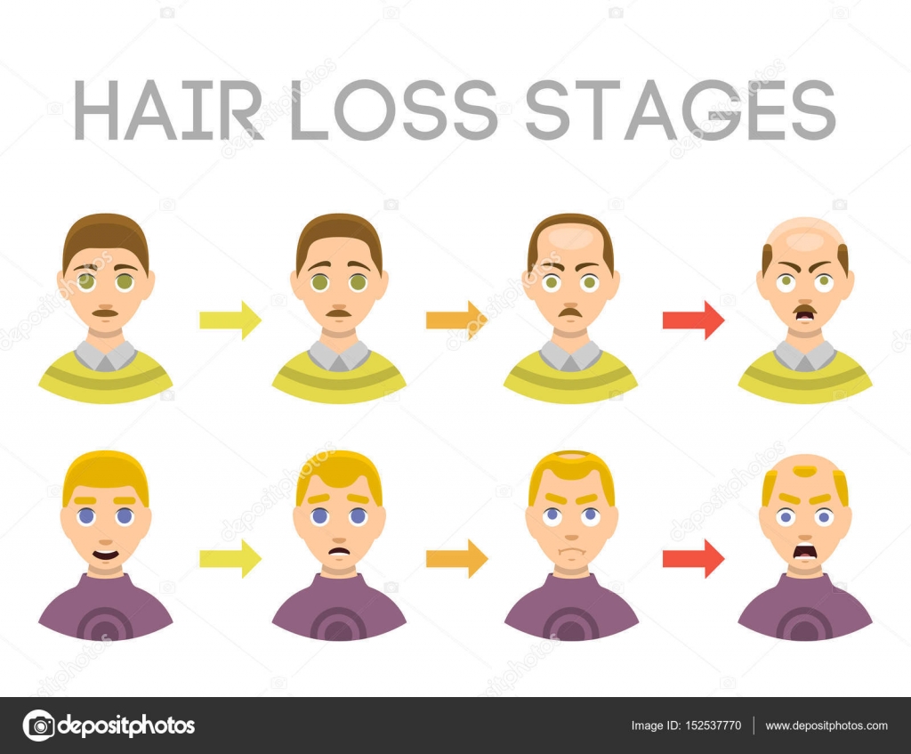 Hairline Chart