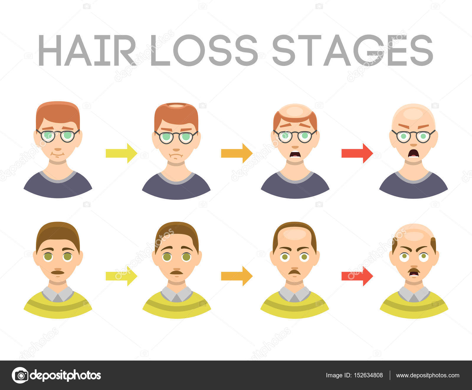 Balding Chart