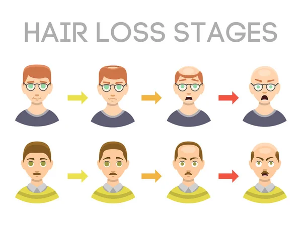 Інформаційна схема стадій випадіння волосся типи облисіння, проілюстрованих на векторі чоловічого голови . — стоковий вектор