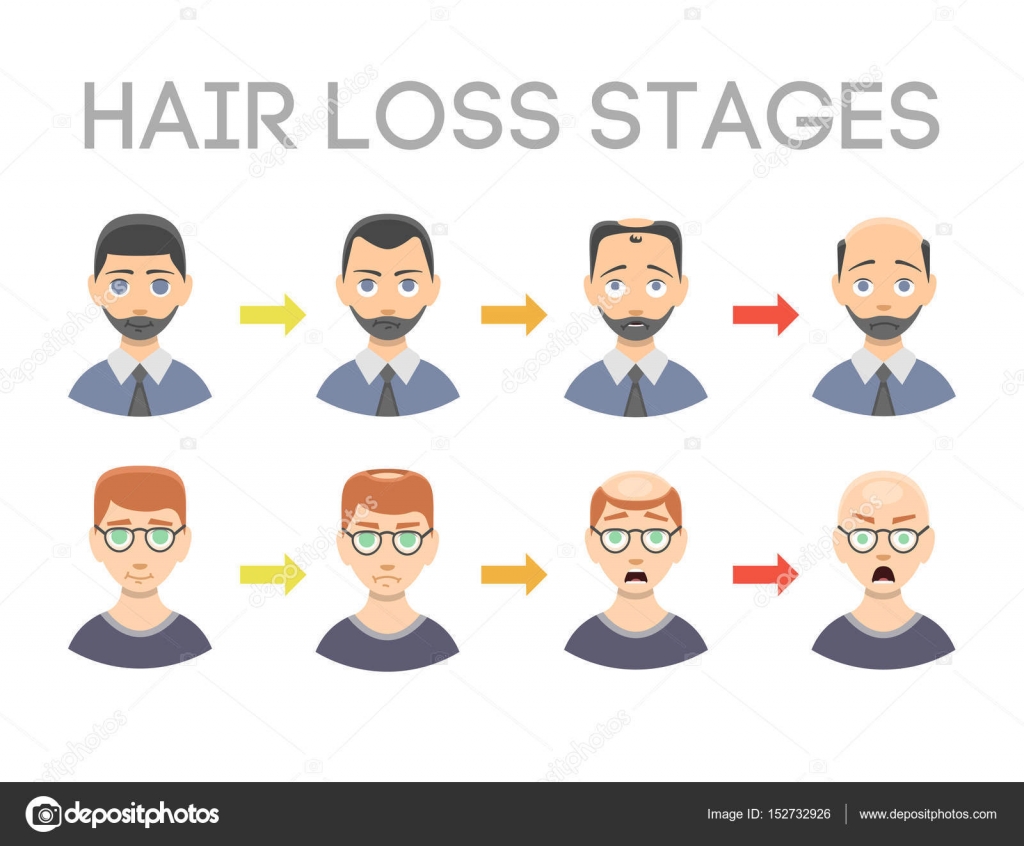 Hairline Chart