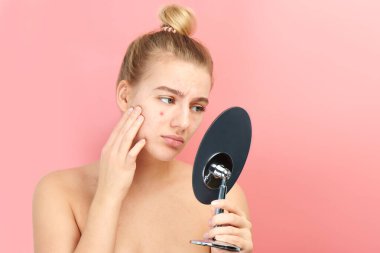 Upset girl looks in the mirror at her problem skin with red acne and post-acne isolated on a pink background clipart