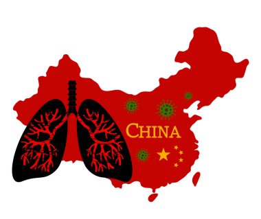 Human lungs are affected by pneumonia coronovirus in China.