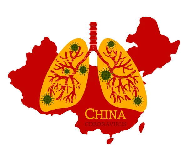 在中国，人类肺受到肺炎病毒的影响. — 图库矢量图片