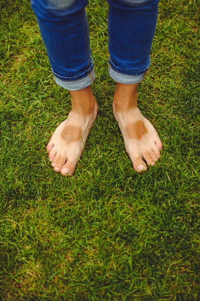 Bir adamın bir düzensiz tan ile bacaklar