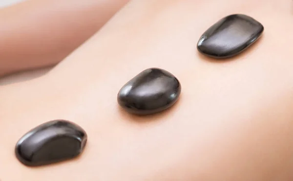 Černý horký kámen odpočívá na ženy pro lázeňské terapie — Stock fotografie