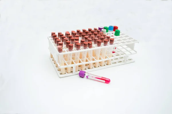 lab equipments : Bottle vaccine, Blood tube,needle,Syring, urine box, sputum box.