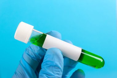 tüp bir eldiven ile elinde virüs ile