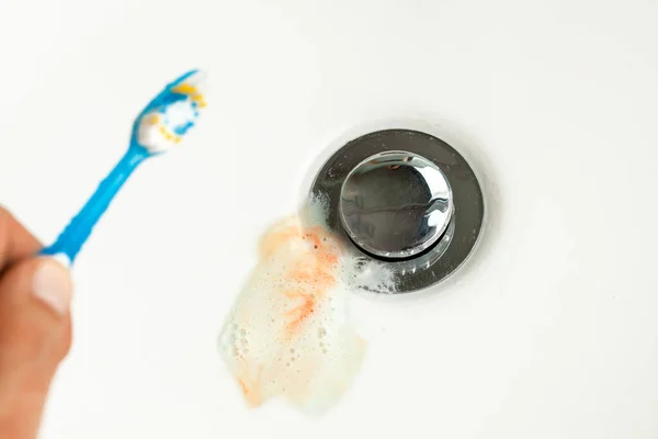 stock image Toothpaste with blood in the sink after brushing your teeth. Bleeding gums