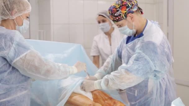 Χειρουργική ομάδα προετοιμασία του ασθενούς για τη χειρουργική επέμβαση σε λειτουργικό δωμάτιο νοσοκομείου. — Αρχείο Βίντεο