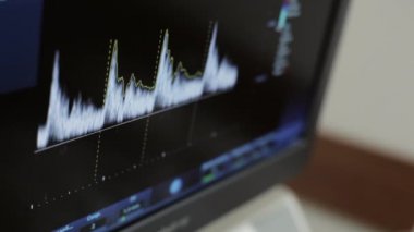 Ultrasonik tarayıcı ekranı ne zaman tarama boyun hasta doktor.