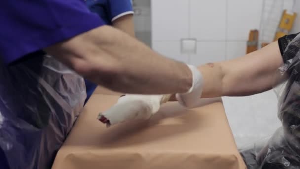El médico yacía sobre el yeso en la mano paciente femenina — Vídeo de stock