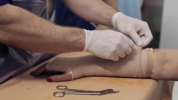 Ärztin lag auf Gips an der Hand einer Patientin — Stockvideo