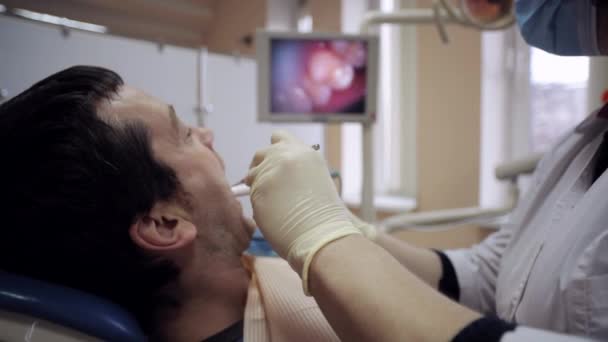 Dentista examinando la boca de un paciente con una cámara intraoral . — Vídeos de Stock