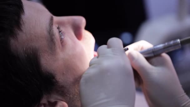 Крупный план стоматолога с использованием зубной дрели на зубах пациентов — стоковое видео