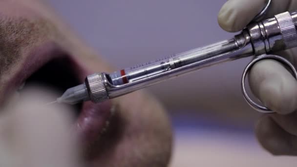 Дантист делает инъекции своему пациенту в стоматологической клинике — стоковое видео