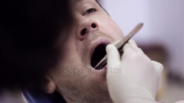 The dentist puts a cotton ball near the patients tooth. — Stock Video