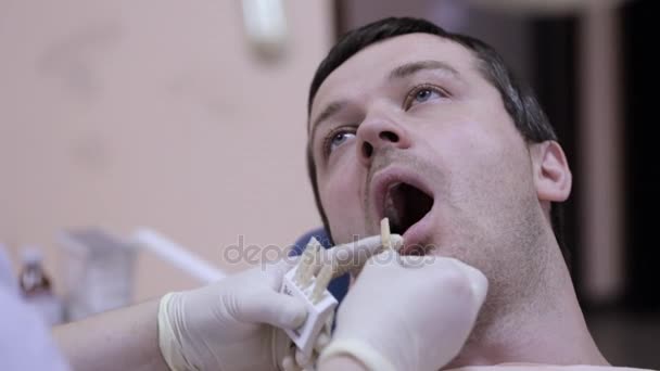 Detail z mladého muže v křesle zubař, zkontrolujte a vyberte barvu zubů. — Stock video