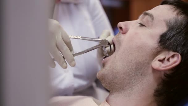 Dentysta przed wysunięciem zębów w klinice stomatologicznej. — Wideo stockowe