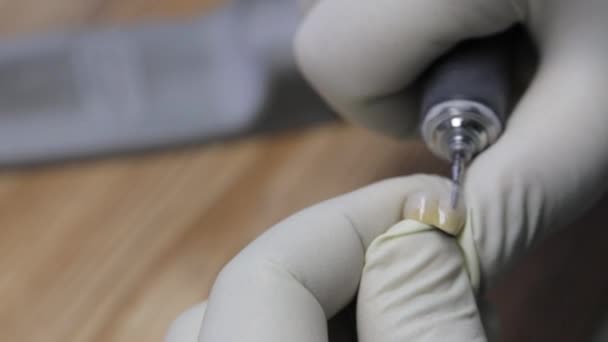 Формування металокерамічного імплантату істота процесу в лабораторії. — стокове відео