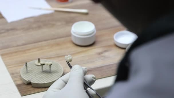 Крупним планом процес створення керамічних імплантатів в лабораторії . — стокове відео